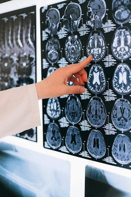 pexels-photo-4226119-4226119 A doctor's hand points to a brain MRI scan on a lightbox, illustrating medical diagnosis.